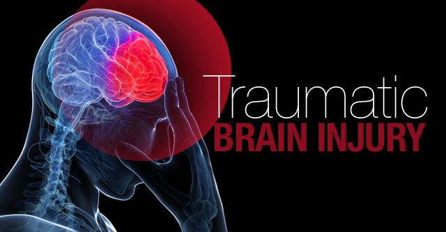 Head and Brain Injuries