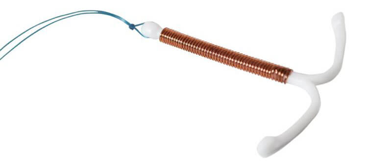 IUD device - Paragard IUD lawsuit