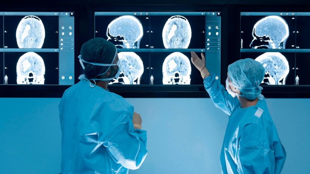 doctors looking at brain scans with blue walls - brain injury claims
