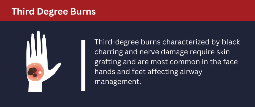 Third-degree burns are characterized by black charring, nerve damage and more.