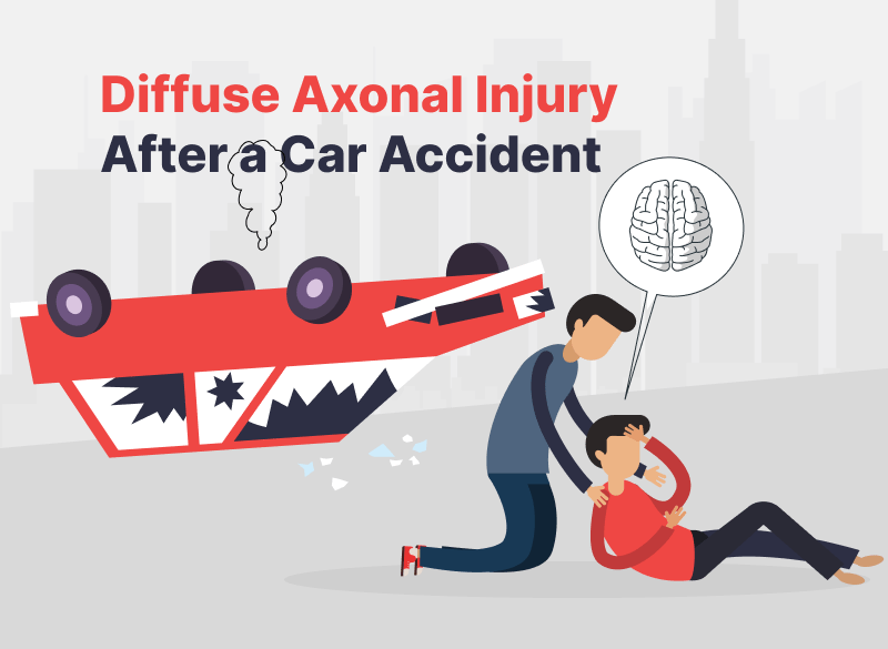 diffuse-axonal-injury-after-a-california-auto-accident