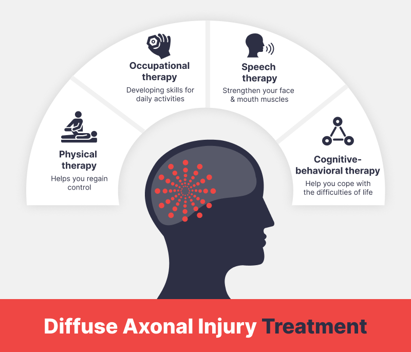 Diffuse Axonal Injury After a California Car Accident