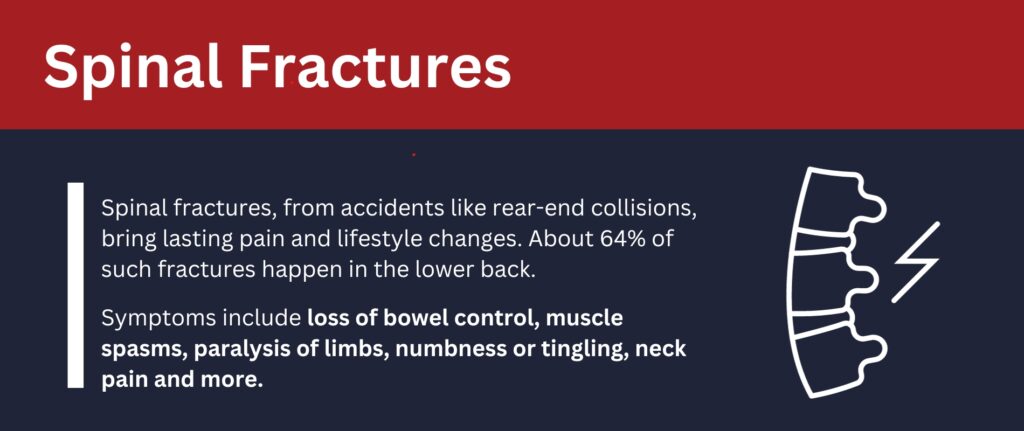Spinal fractures, from accidents like rear-end collisions, bring lasting pain and lifestyle changes.