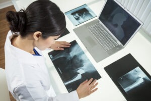 A female doctor looking at pictures of hip implant x-rays on her white desk.